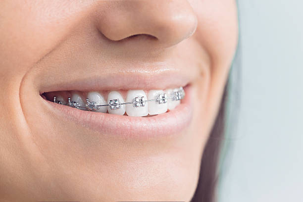 Best Dental Inlays and Onlays  in Woodworth, OH